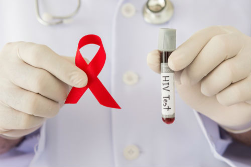 банер Безплатни изследвания за ХИВ през периода от 22 до 26 август 2022г.